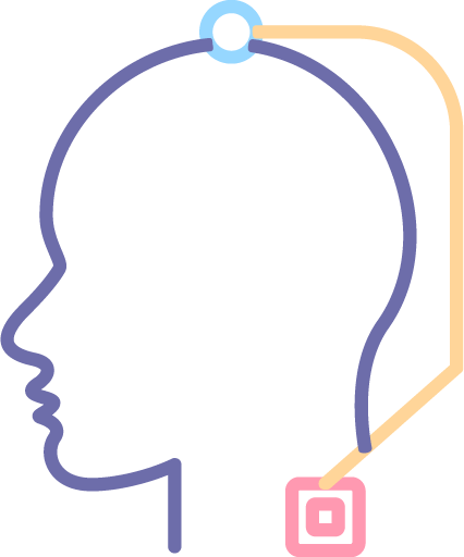 Deep Brain Stimulation